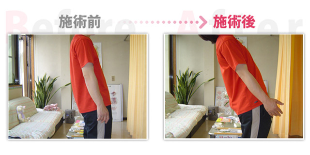 腰痛改善。（治療効果：名古屋市在住）