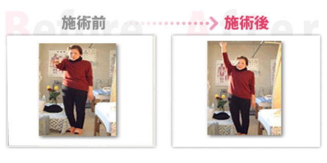 肩の痛み、五十肩改善。(名古屋市在住) 肩の痛み、五十肩改善。(名古屋市在住)