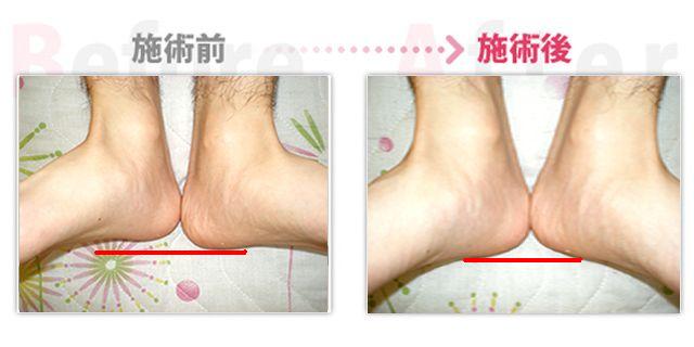 骨盤矯正で腰痛、肩こりが楽になっています。（西尾市在住）