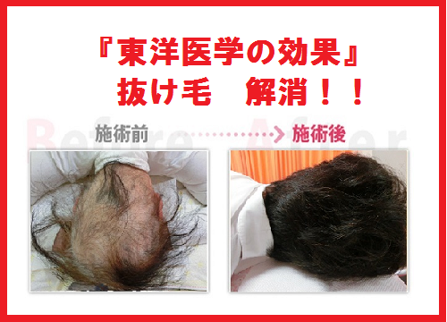 画像の説明 画像の説明