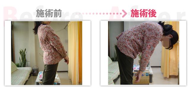 腰痛、ぎっくり腰、肩こり改善。（治療効果：豊田市在住）