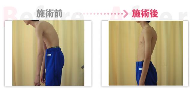 背中の痛み改善。（治療効果：岡崎市在住）