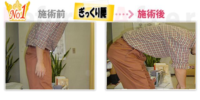 ぎっくり腰改善。(安城市在住) ぎっくり腰改善。(安城市在住)
