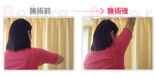 四十肩・五十肩改善(知立市在住) 四十肩・五十肩改善(知立市在住)