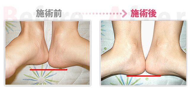 骨盤矯正で肩こり、腰痛解消。（刈谷市在住）