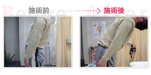 腰痛改善。（岡崎市在住）